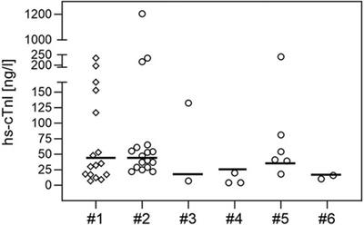 High-sensitive cardiac troponin I (hs-cTnI) concentrations in newborns diagnosed with spinal muscular atrophy